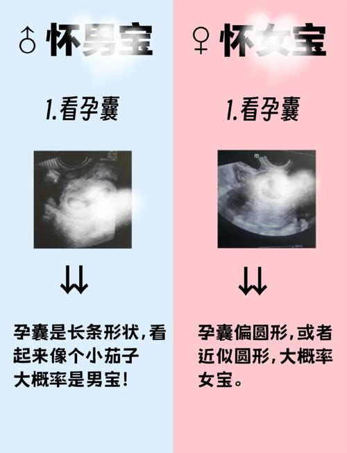 安全期怀孕会是男孩吗