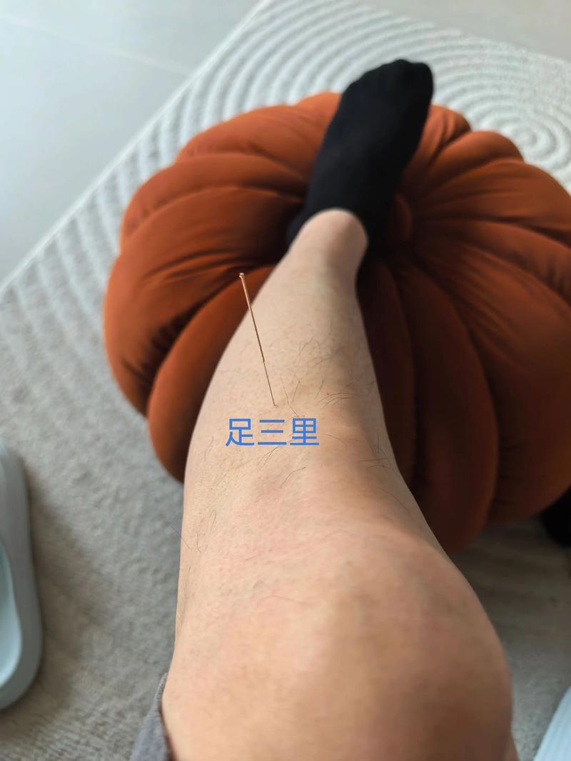 脾胃虚寒可以针灸吗