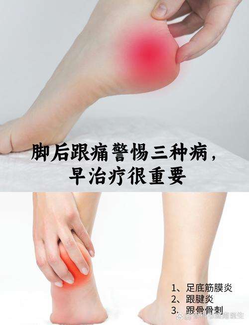 走路脚后跟疼是痛风吗