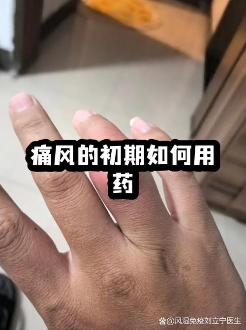 痛风吃秋水仙碱还是疼