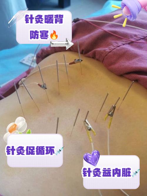 针灸过后可以按摩吗