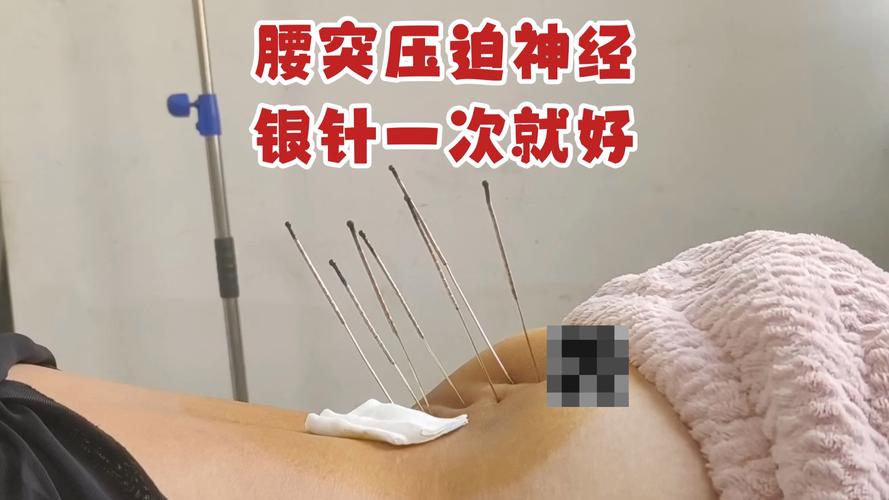 肾不好腰痛怎么针灸