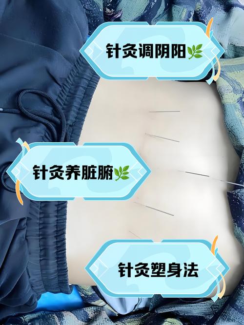 腹部针灸治疗什么病