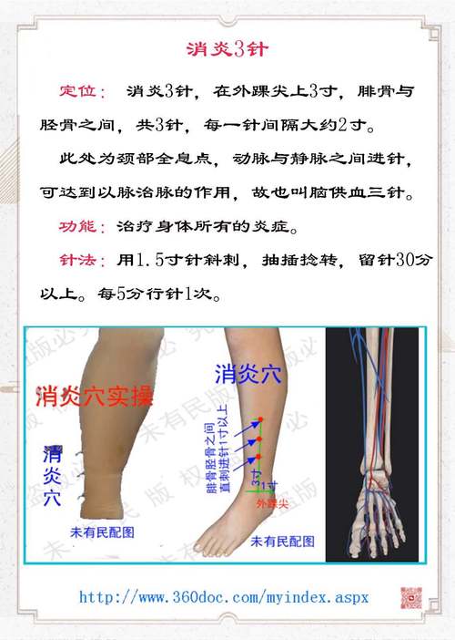 眼底出血的针灸治疗