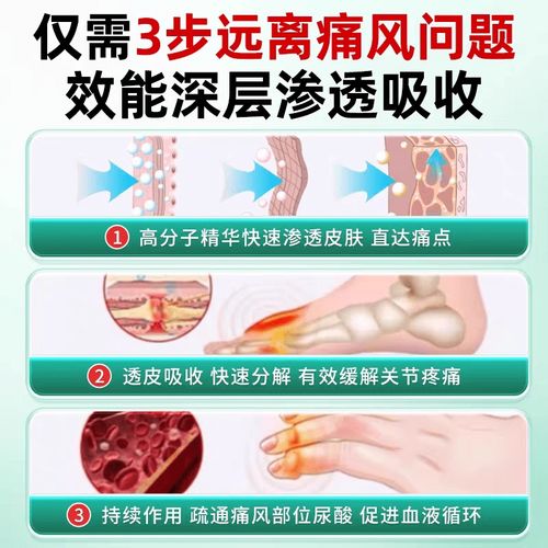 痛风能贴活血止痛膏吗