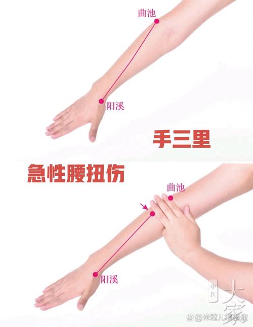 急性腰扭伤针灸哪里