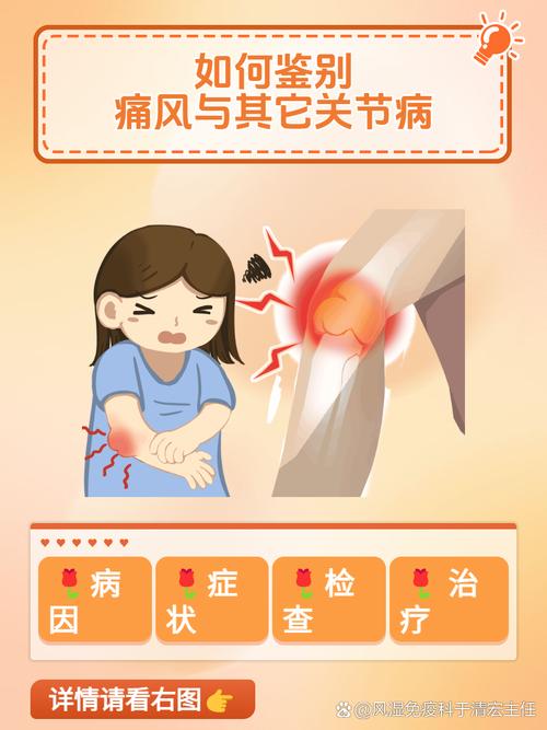 痛风和中风有什么区别