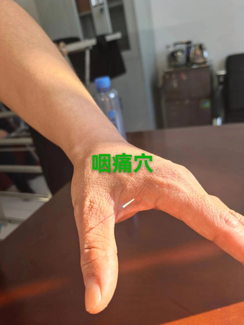 咽喉疼针灸手上哪里