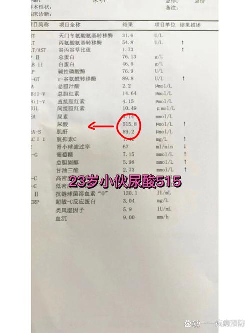 痛风做什么检查才确诊