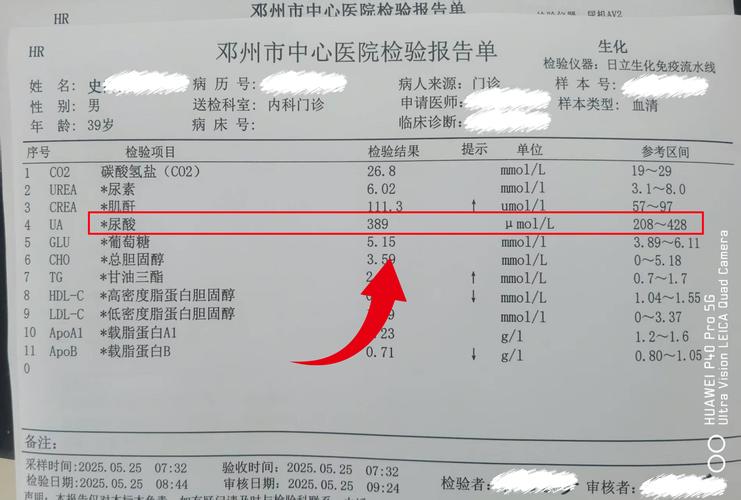 痛风做什么检查才确诊