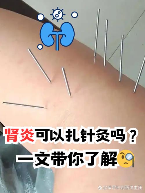 针灸尿失禁治疗方法