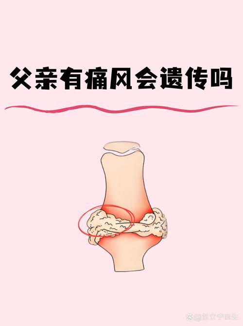 痛风会不会遗传下一代