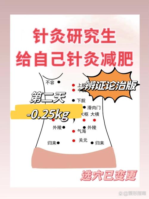 针灸减肥哪里可以学