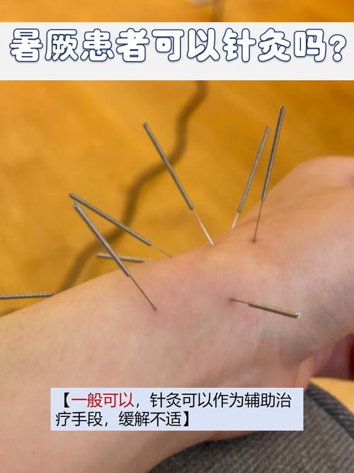 针灸可以治疗湿热吗