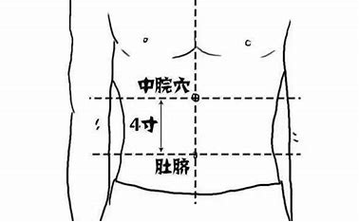 减肚子针灸哪个部位
