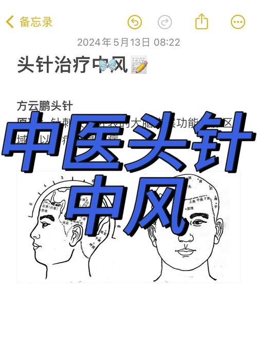 针灸可以治疗脑瘫吗