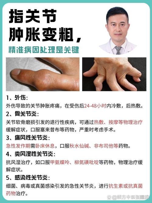 痛风关节肿大能恢复么