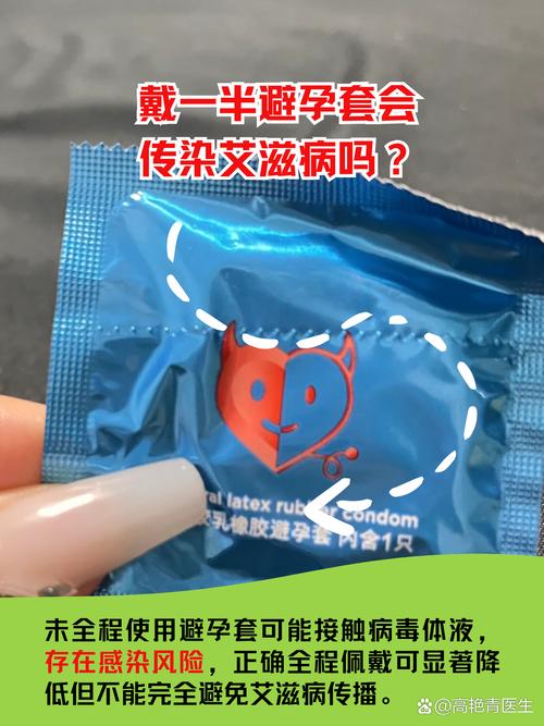 带着安全套会会感染吗