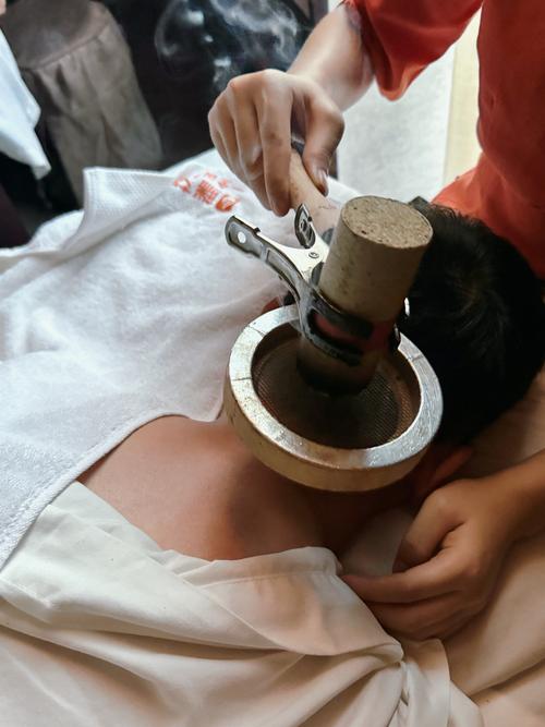 鞍山哪有祖传扎针灸