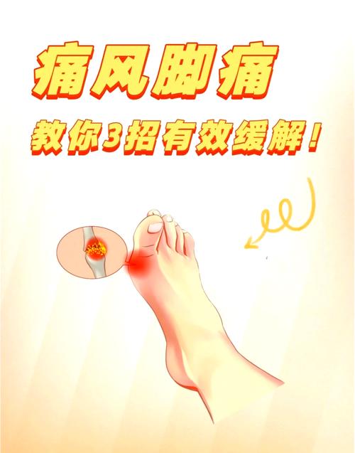 痛风腿疼的厉害怎么办