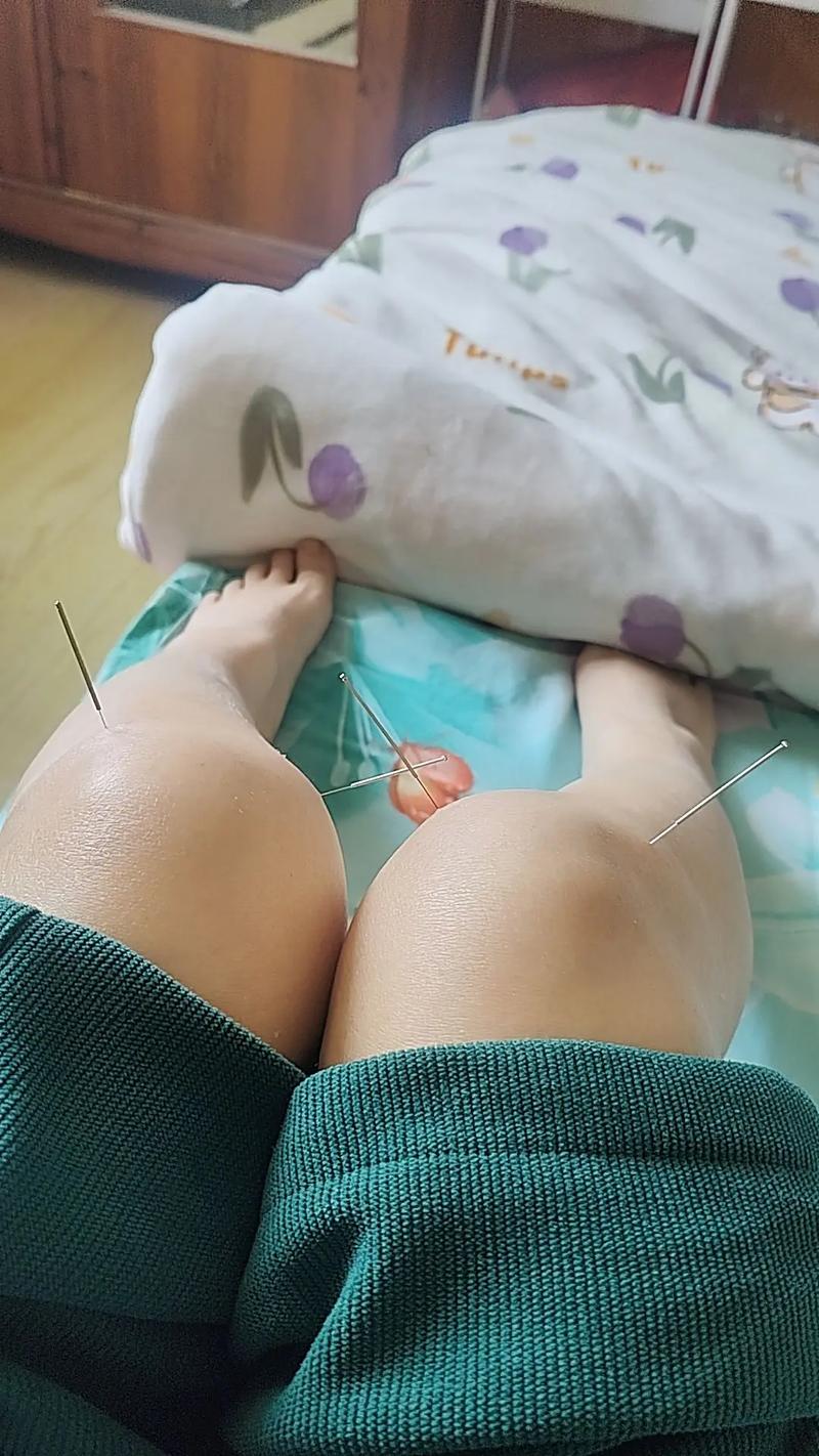 大腿内侧疼怎么针灸