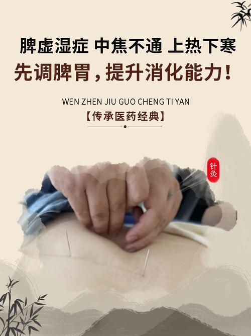 中医针灸减肥哪里好