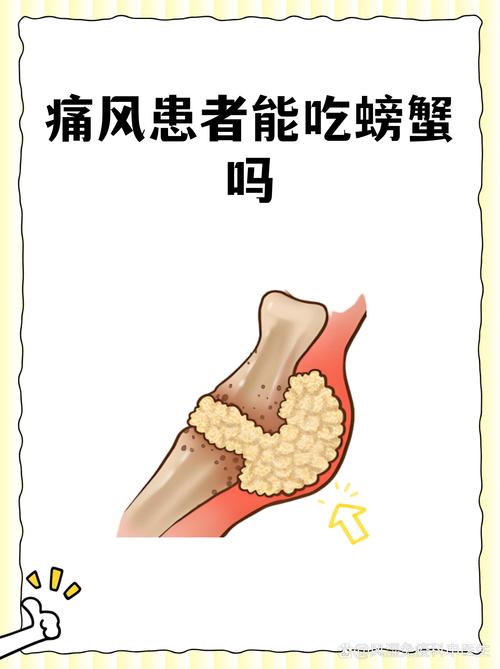 有痛风的人能吃螃蟹吗