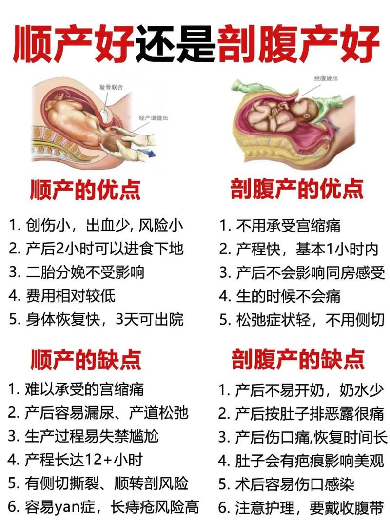 乡镇医院剖腹产安全吗