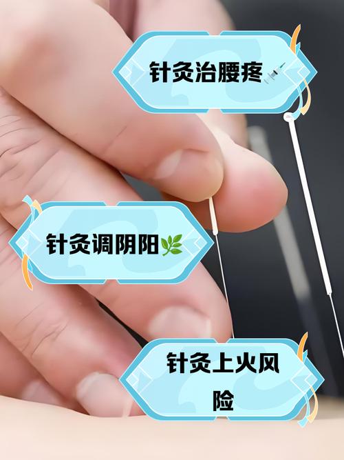 针灸可以治疗疼痛吗