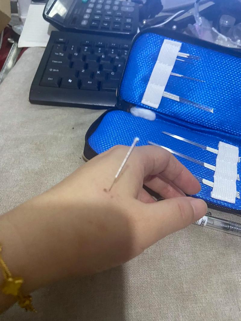 小儿惊吓针灸扎哪里