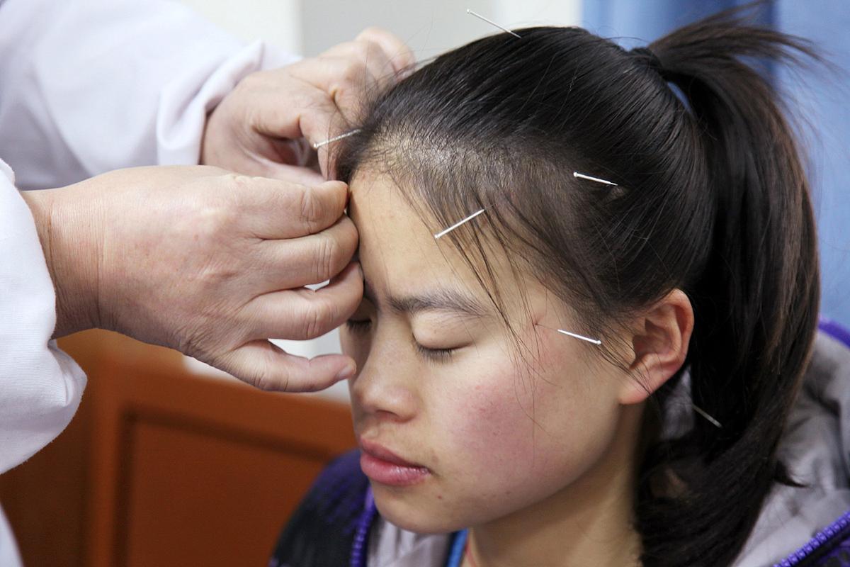 慢性紧张性头痛针灸