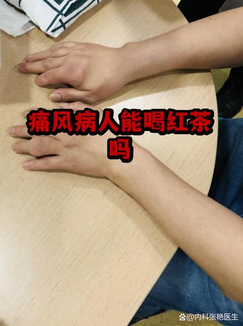 痛风病人能喝葡萄酒吗