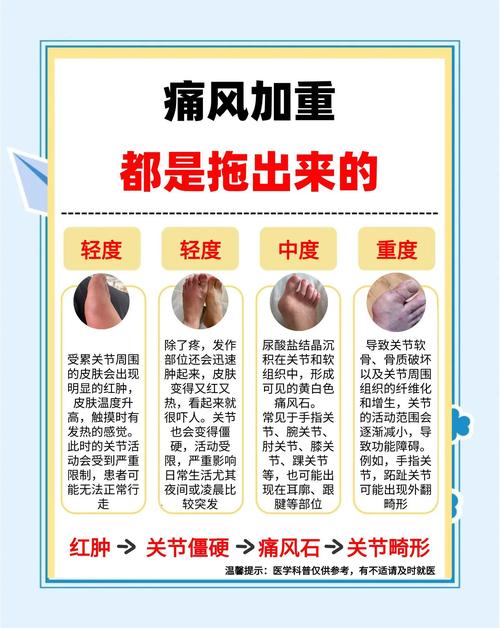 剧烈运动会引起痛风吗