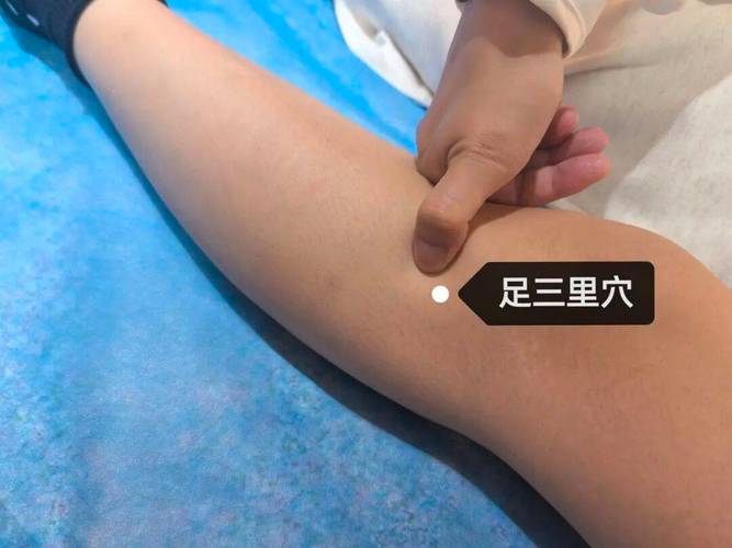 肠胃胀气的针灸治疗