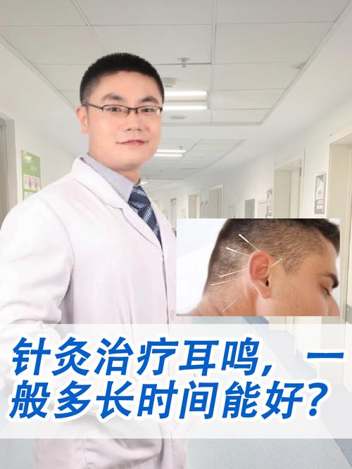 北京针灸耳鸣的医院