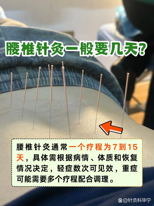 针灸治病大概得多久