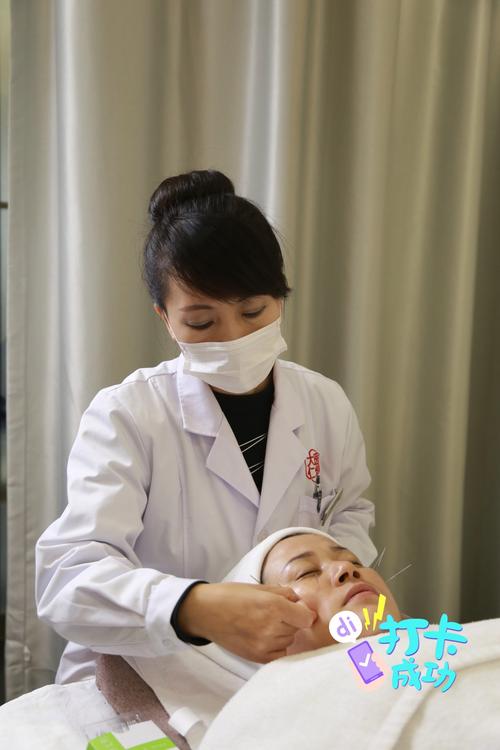 针灸治疗对身体好吗