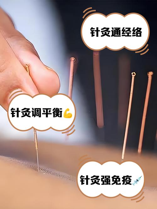 针灸治疗对身体好吗