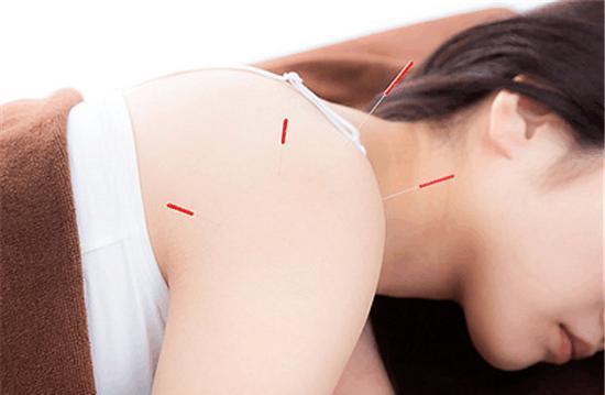 乳腺囊肿可以针灸吗