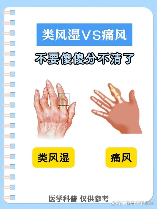 类风湿和痛风哪个严重