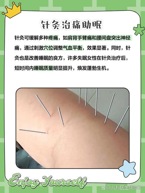 针灸可以治不孕不育