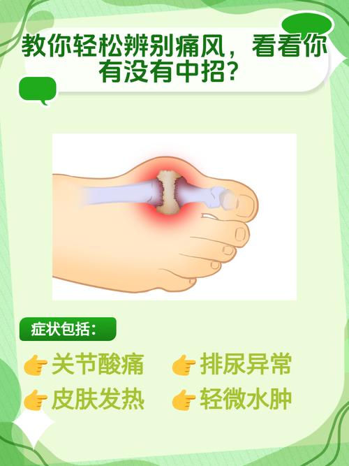 如何判断是否得了痛风