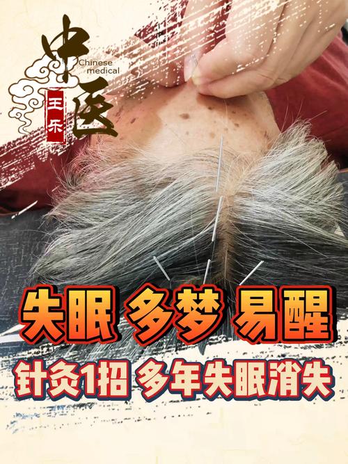 失眠针灸有什么危害