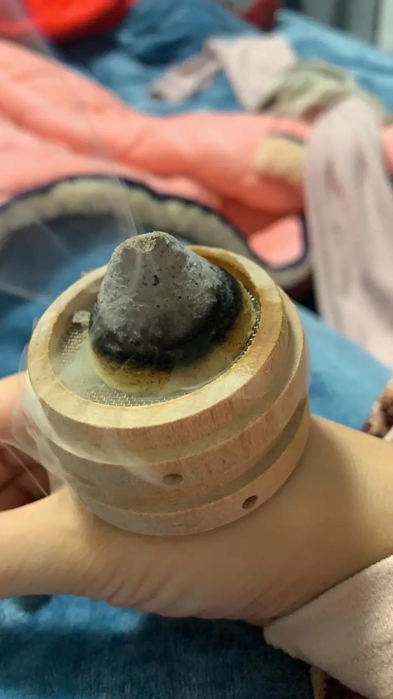 艾灸可以代替针灸吗