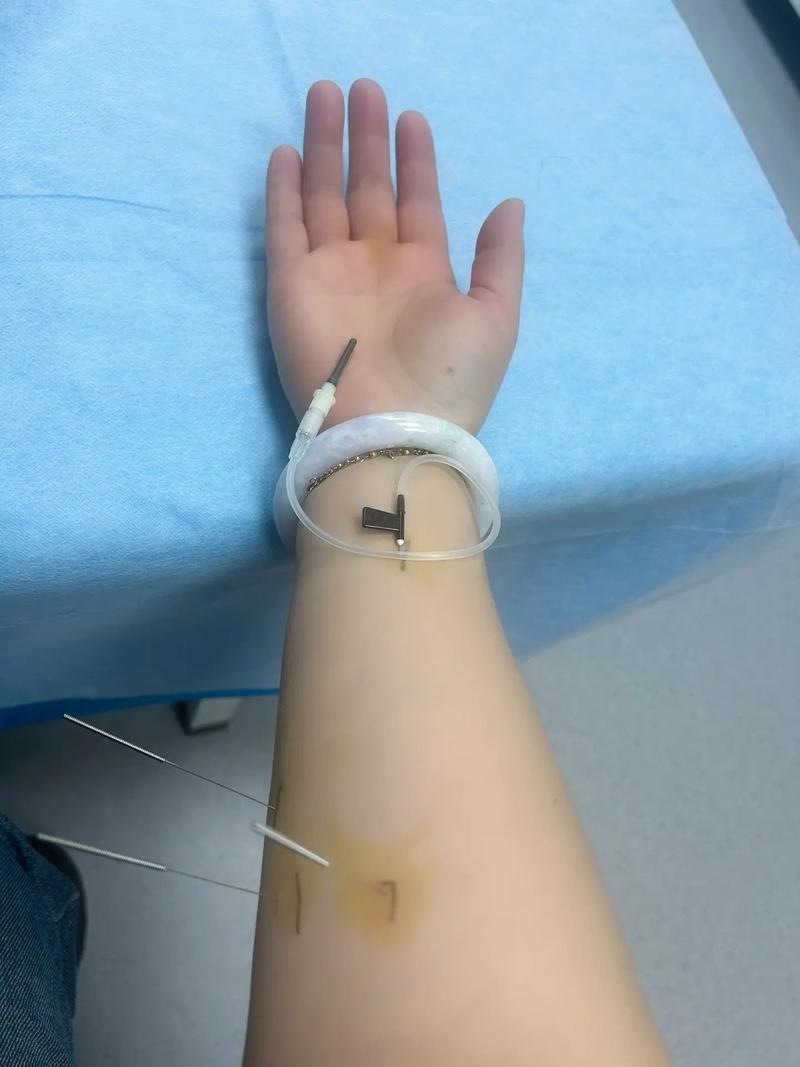 北京核工业医院针灸