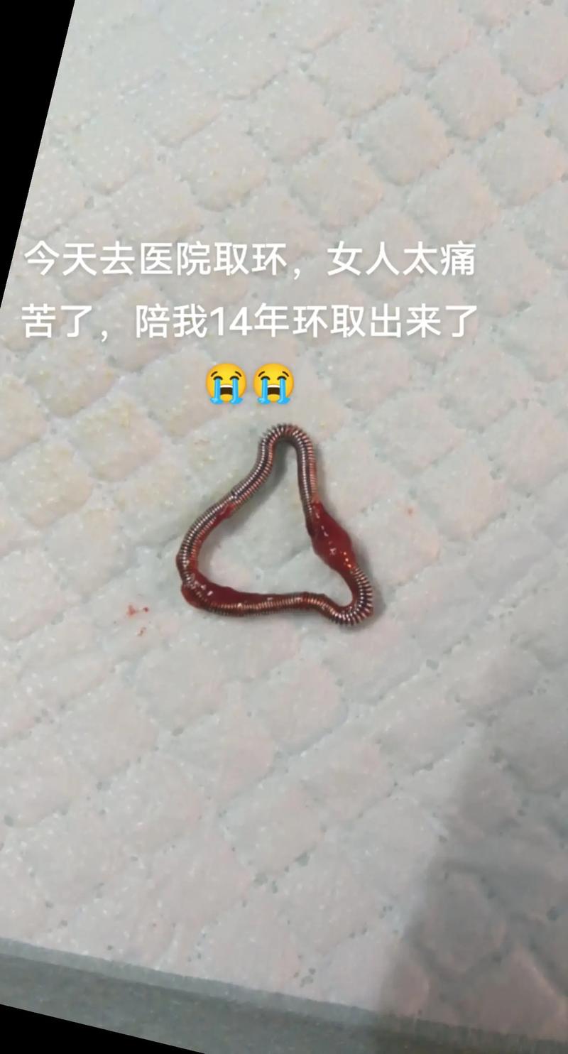 有子宫肌瘤取环安全吗
