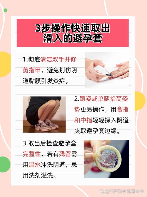 女用安全套的用法视频