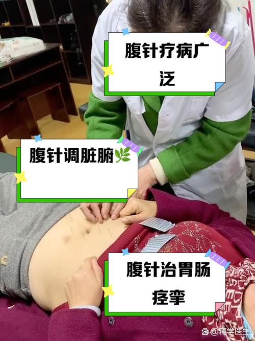 针灸能促进肠道蠕动