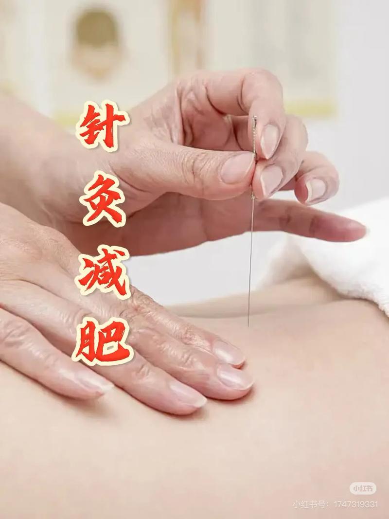 针灸能促进肠道蠕动