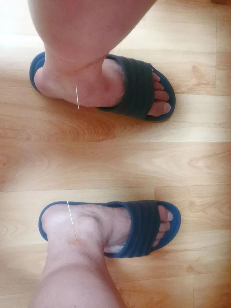 成都针灸推拿哪里好